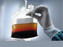 Morire per sangue infetto a Cosenza