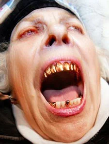 Denti d'oro alla Patria